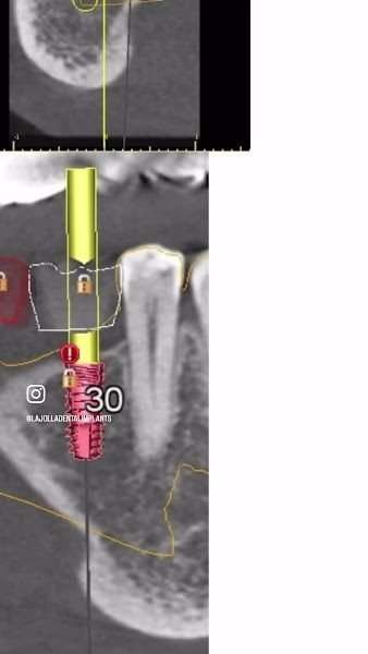 La Jolla Dental Implants & Periodontics 6