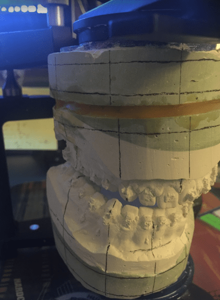 Long Beach Oral and Maxillofacial Surgery