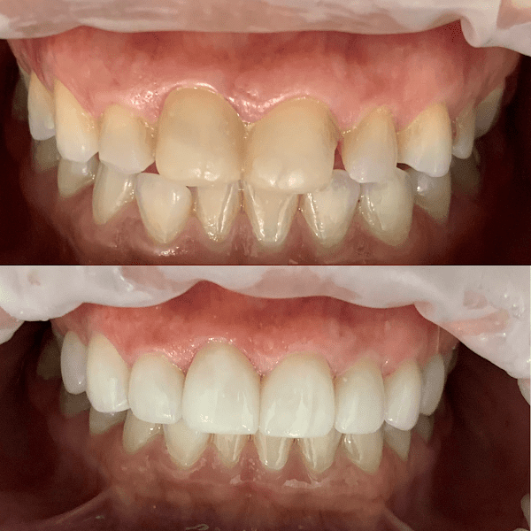 Lux Dental Studio - Houston