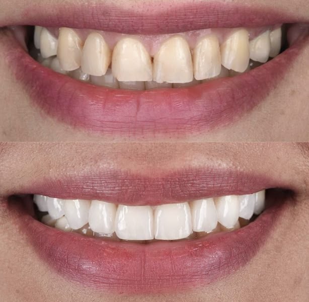 New Smiles Dental Implant Center