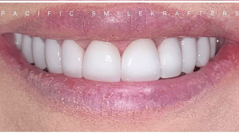 Pacific Smilekrafters