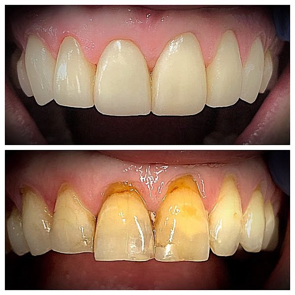 Perio Implant Health Professionals 5