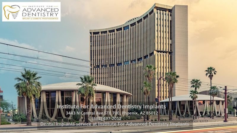 Renew Smiles Dental Implant Center – Phoenix 5