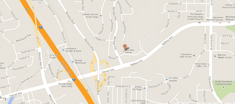 San Diego Dental Implant 2