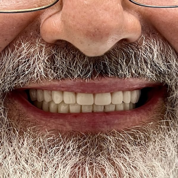 Smile Designers Dental Implant Center