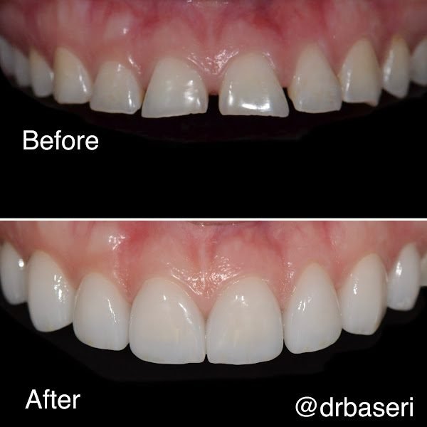 Smile Recreation Dentistry by Dr. Baseri