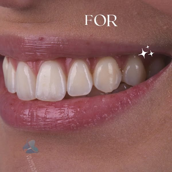 Texas Dental Solutions Dr. Mireya Imitola D.D.S & Dr. Bruce Barbash D.D.S. 3