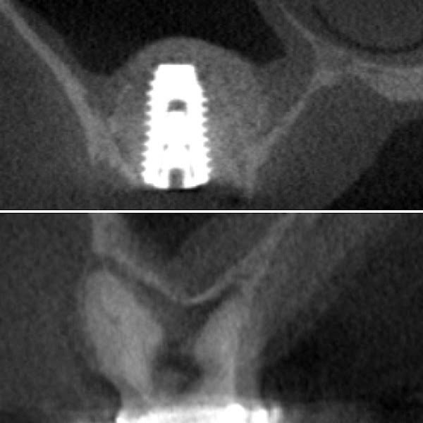 University Dental Implant Center 2