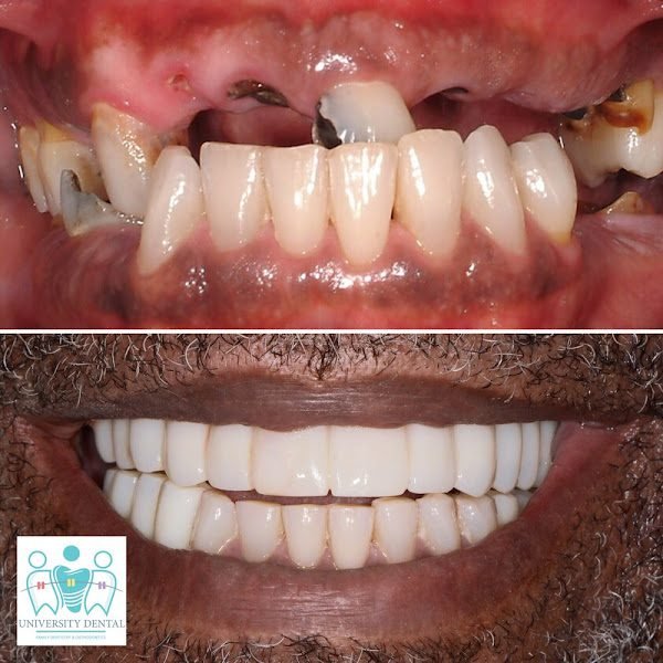 University Dental Implant Center 3