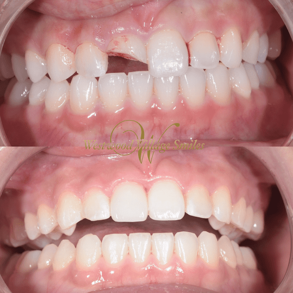 Westwood Dental Smiles 6