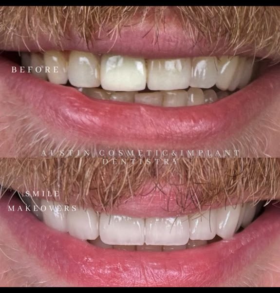 Austin Cosmetic & Implant Dentistry
