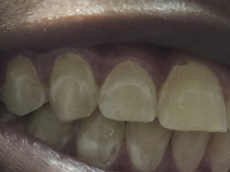 Baymeadows Park Dental 5