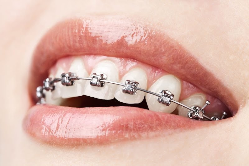 Castillo Dental Group Orthodontics and Implant Center