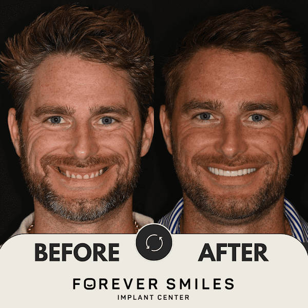 Forever Smiles Implant Center