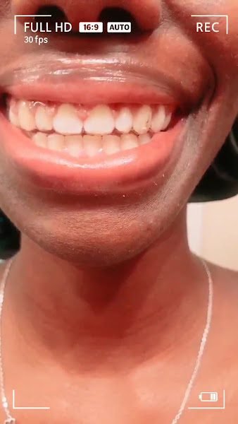 Great Expressions Dental Centers - Beaches Ortho 5