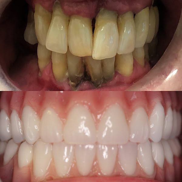 4M Dental Implant Center - Las Vegas 2