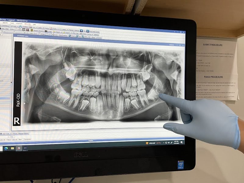 86th Street Complete Dental