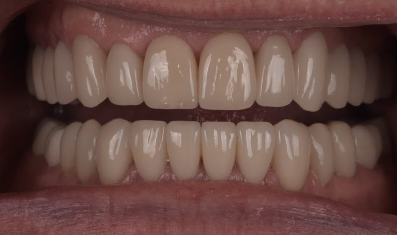 Above & Beyond Dentistry & Implants