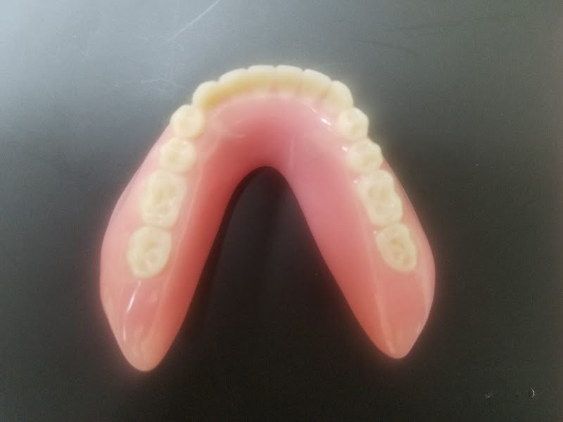 Accusmile Denture 3