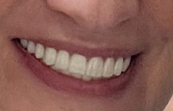 Ace Dental Boston 5