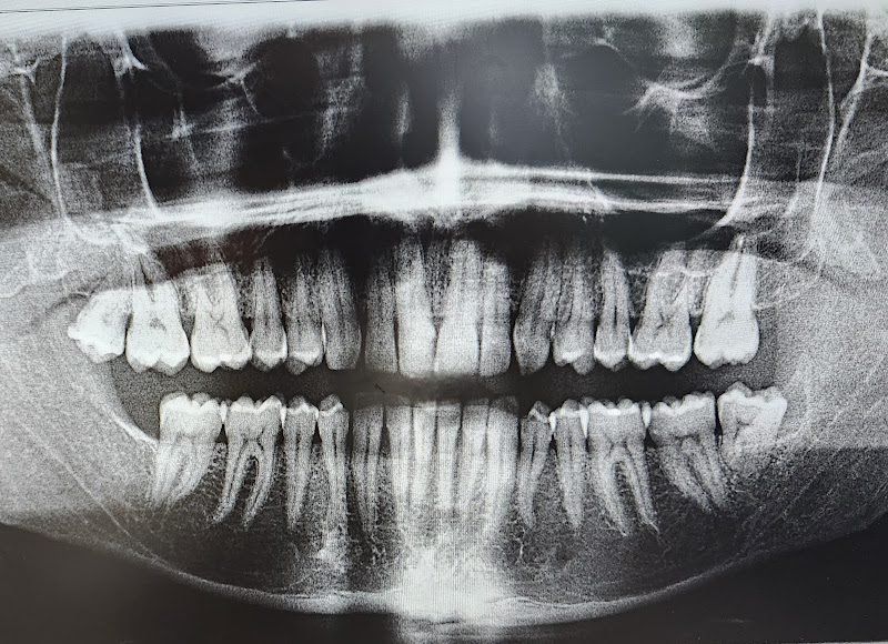 Advantage Dental+