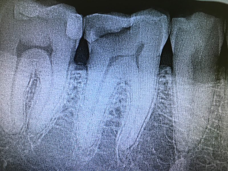 Barnes Dental