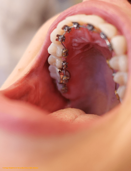Bellevue Orthodontics & Smile Designs
