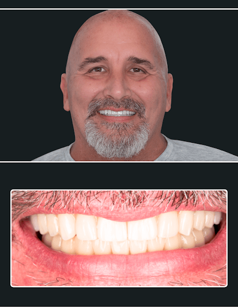 Carolina Implants & Periodontics 2
