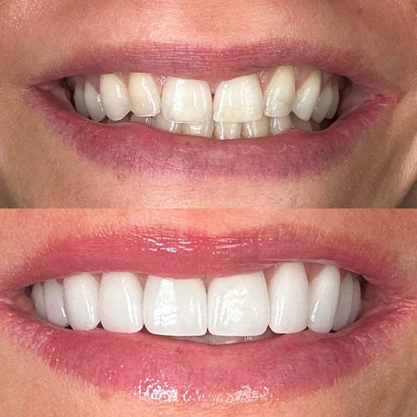 Centerport Cosmetic & Implant Dentistry