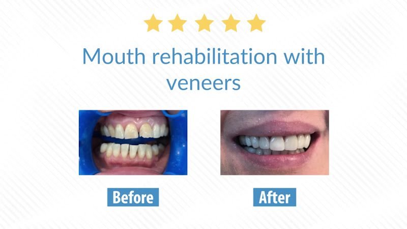 Clínica Dental Laser 2