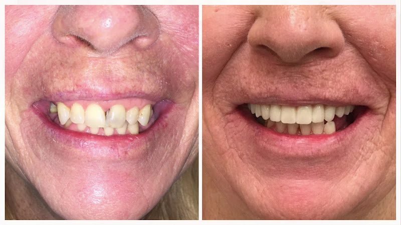 DENTOLOGY Implant center TMJ TMD Dentist 2