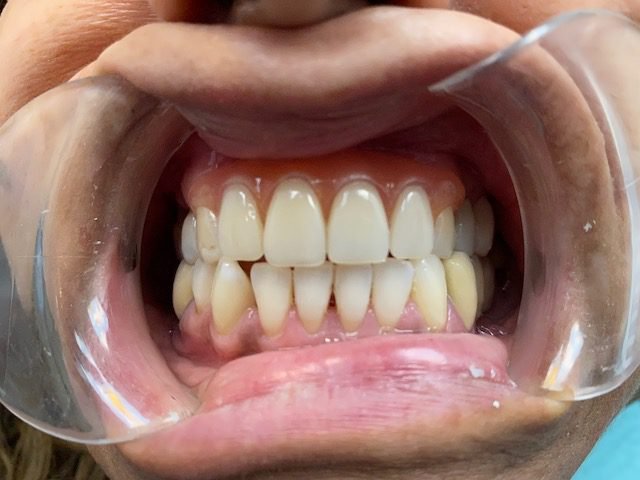 Dr. Gustavo N. Mongelos, DDS