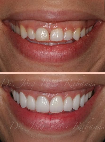 Dr. Jorg-Peter Rabanus, DDS