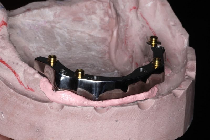 Dr. Nicholas Miller - Miller Prosthodontics 2