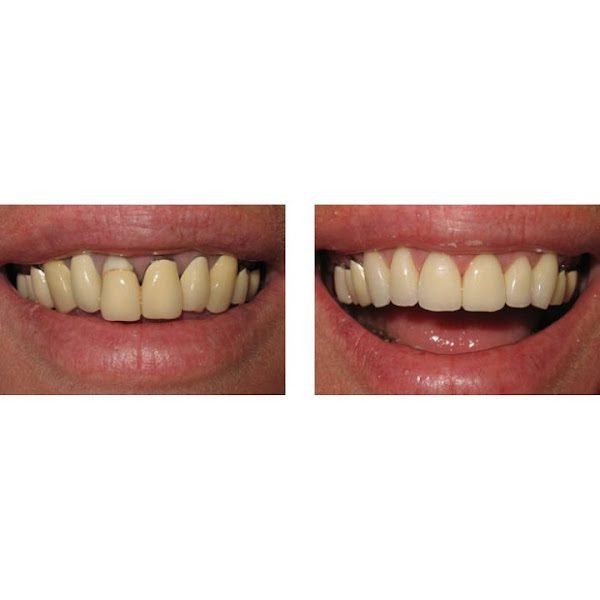 Eastside Prosthodontics - Dr. Rosario Palacios 4
