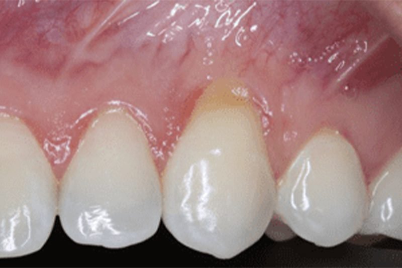 El Paso Periodontics & Implant Specialists 2
