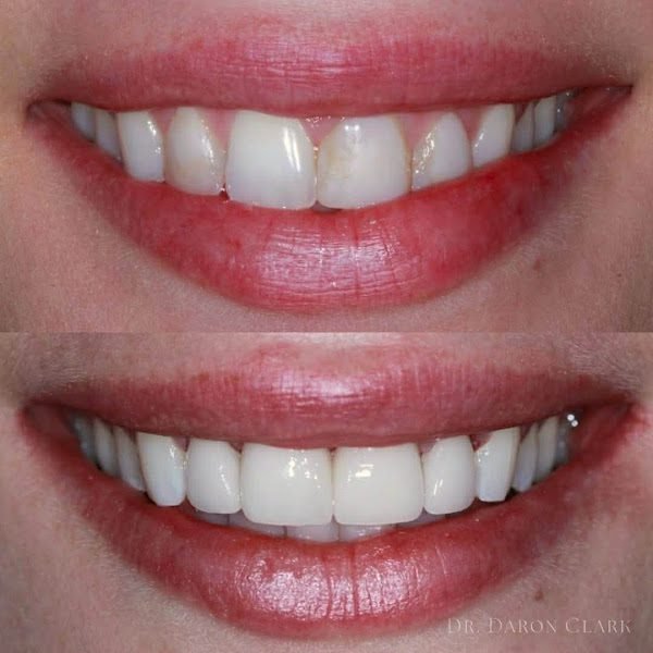 Gulch Dental Studio 5
