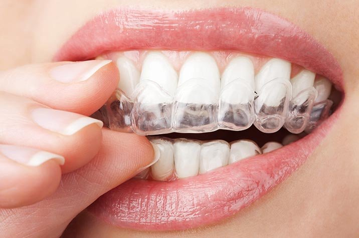 Holistic Dental LV 2