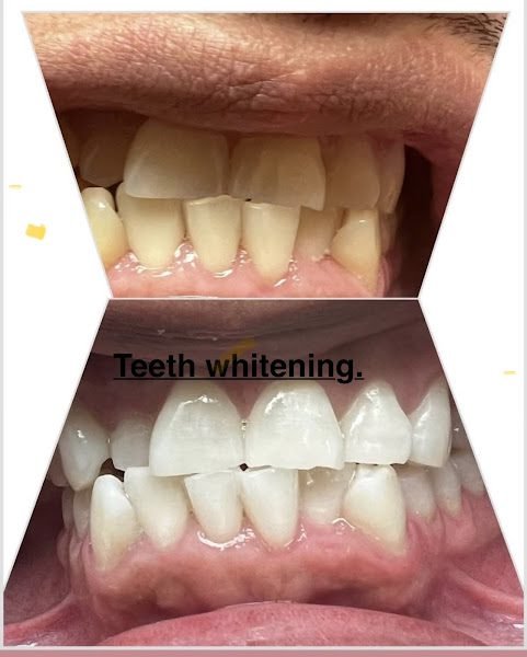 Hour Dental