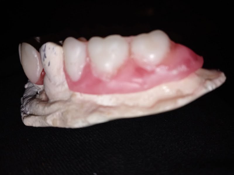 Just Dentures 2