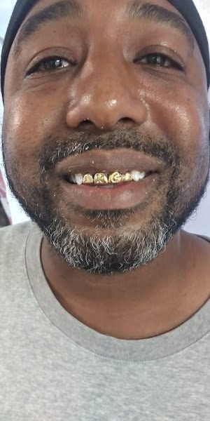 Market Street Denture Center 4