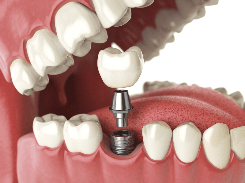 Mass Dental Associates