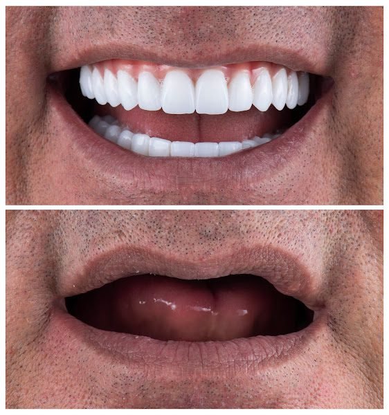Memphis Dentures and Implants 2