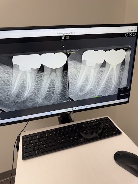 Memphis Endodontics