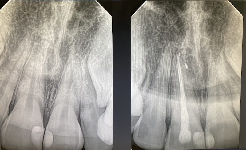 Memphis Endodontics, Bartlett