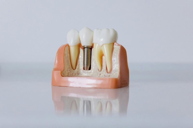 Metrolina Periodontics & Dental Implants 5