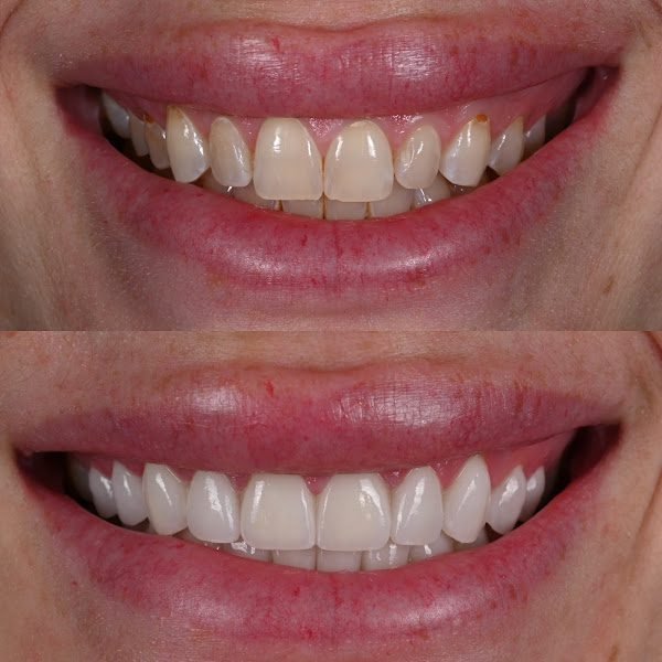 Morton Aesthetic and Implant Dentistry of Nashville 3