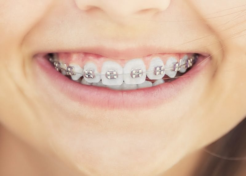 Music City Orthodontics