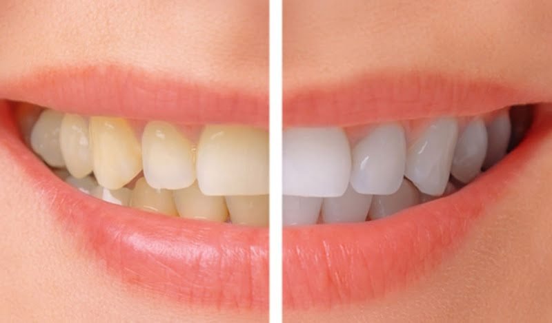 NW Prosthodontics