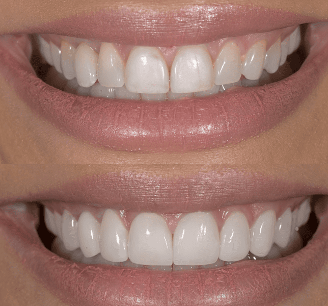 Nashville Aesthetic Dentistry 4